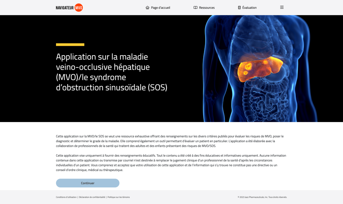 vignette du site Web du navigateur MVO